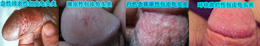 �����ϳ��������ô����?